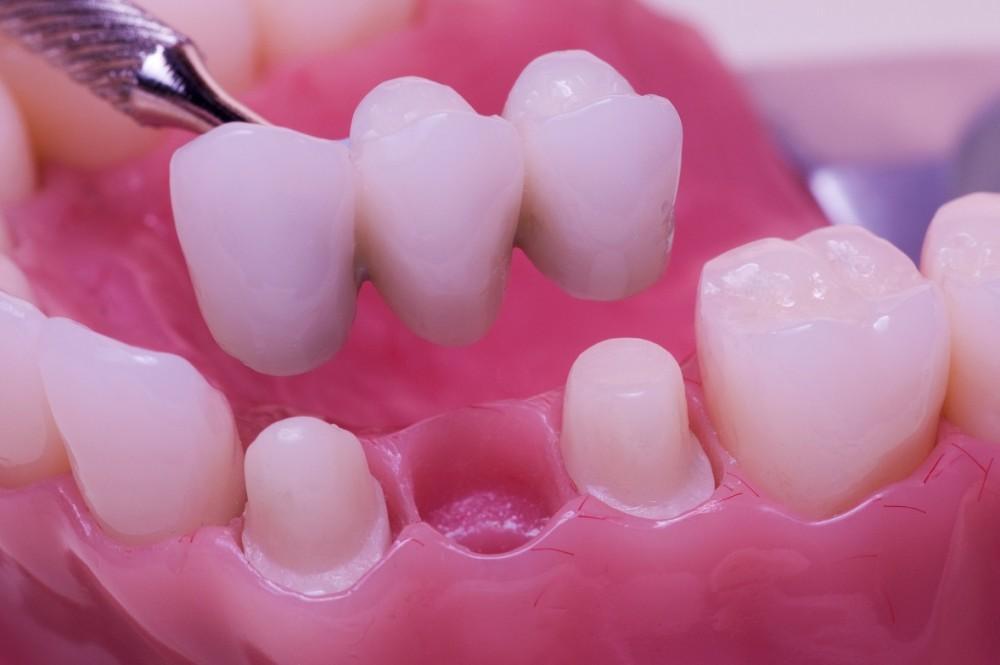Dentures